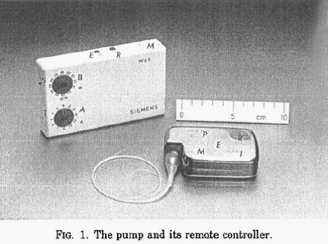 The Implantable Insulin Pump, History